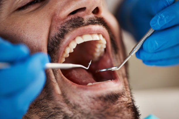 Best Pediatric Emergency Dentist in Rochester, IN